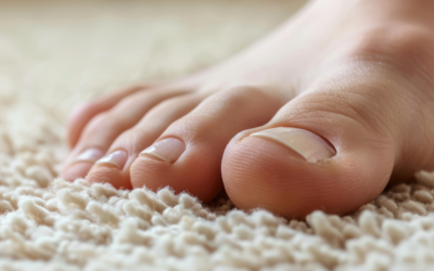 Dealing with Recurring Ingrown Toenails: Causes & Solutions