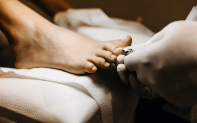 How to Cut an Ingrown Toenail