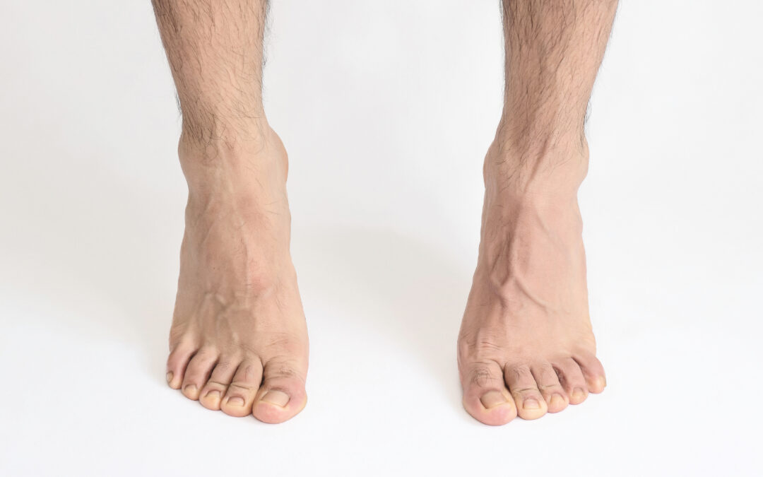 What Kills Toenail Fungus Immediately?