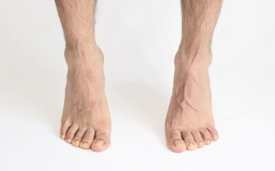 What Kills Toenail Fungus Immediately?