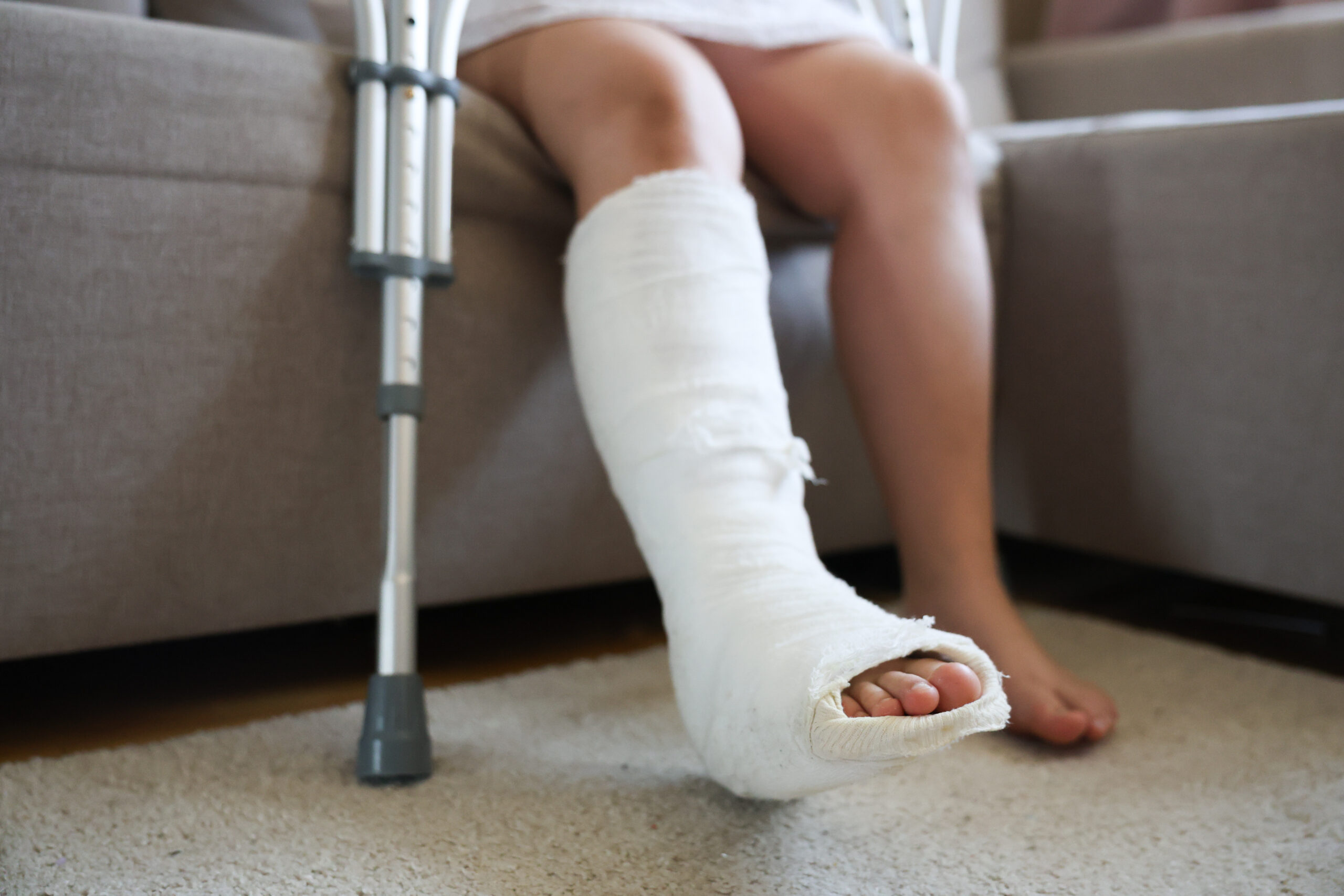 girl with a broken leg in a cast and bandage sits on a sofa metal crutches with height adjustment are at her feet sore leg in focus healthy leg out of focus girl with a broken leg in a cast and bandage sits on a sofa metal crutches with height adjustment are at her feet sore leg in focus healthy leg out of focus