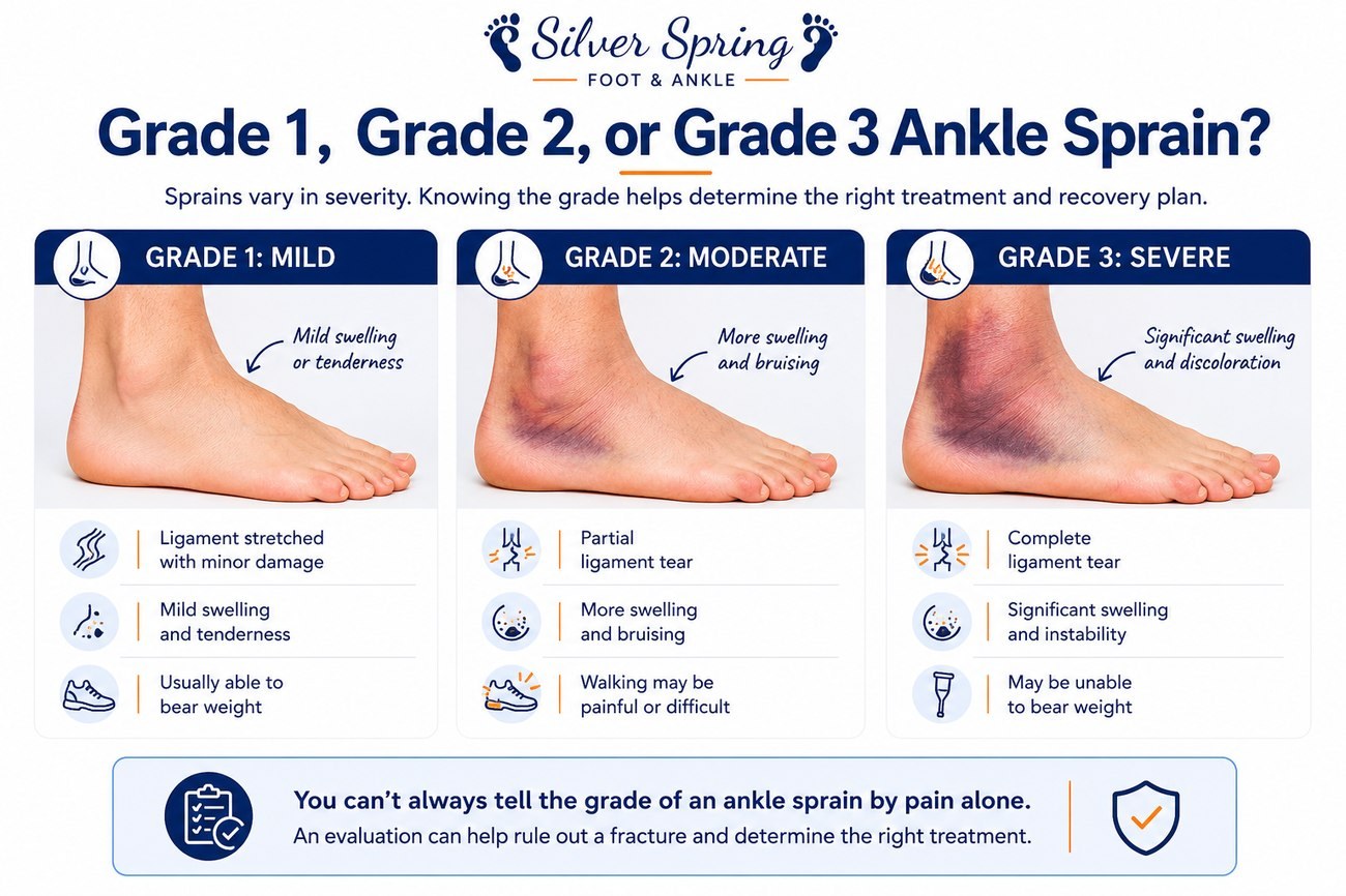 The grades of ankle sprain