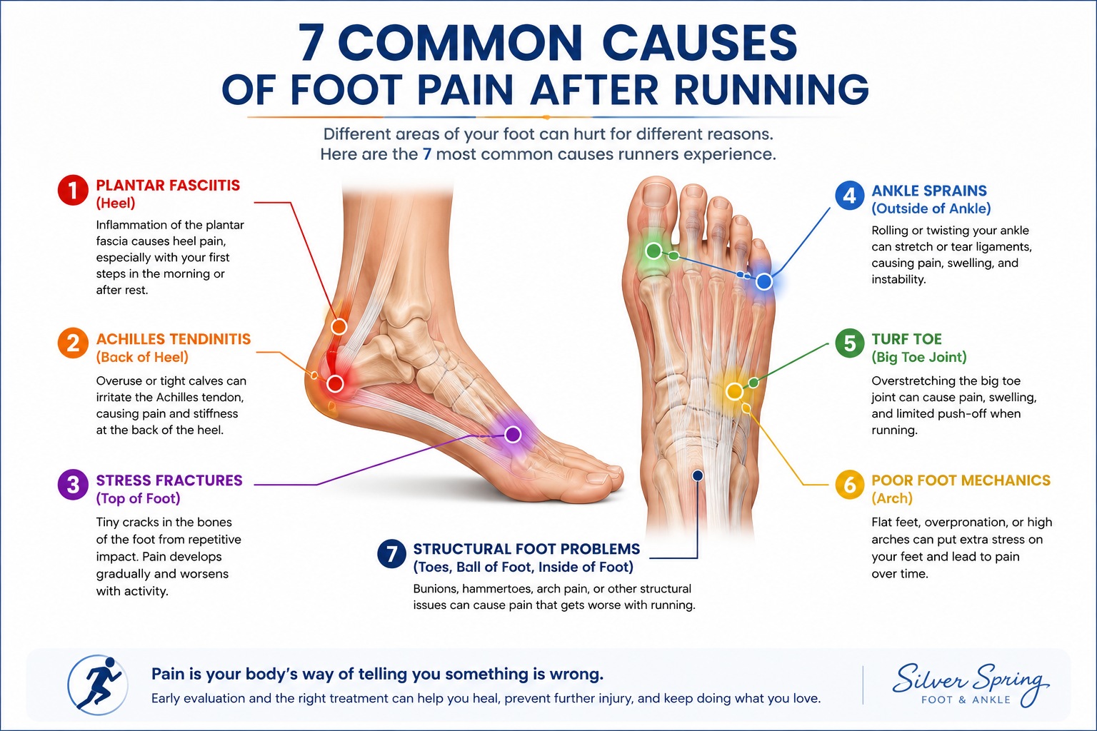 7 common causes of foot pain after running