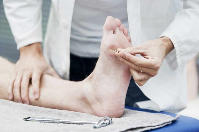 Foot Neuropathy