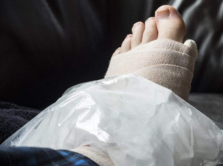 Foot Stress Fractures