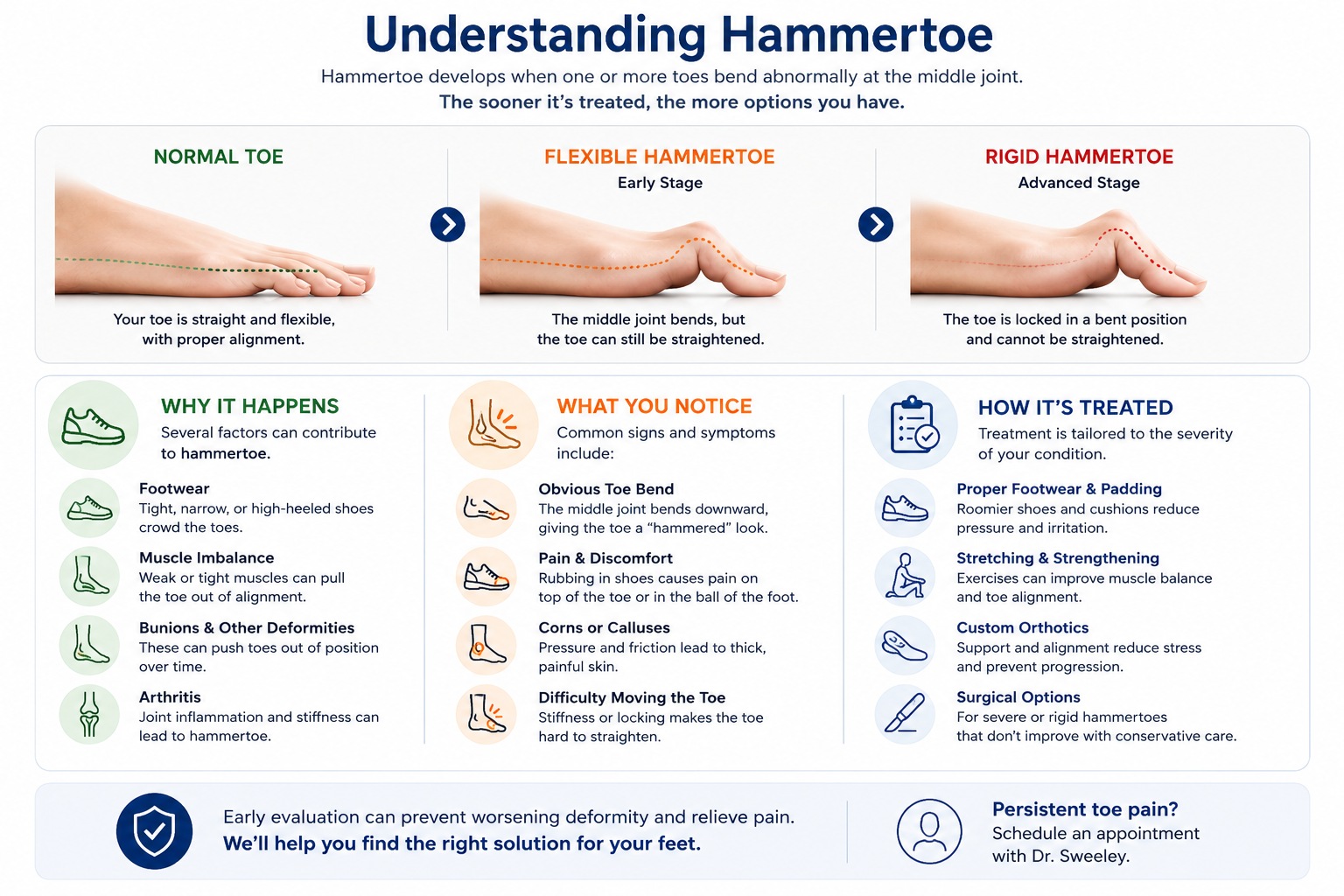 Understanding hammertoe