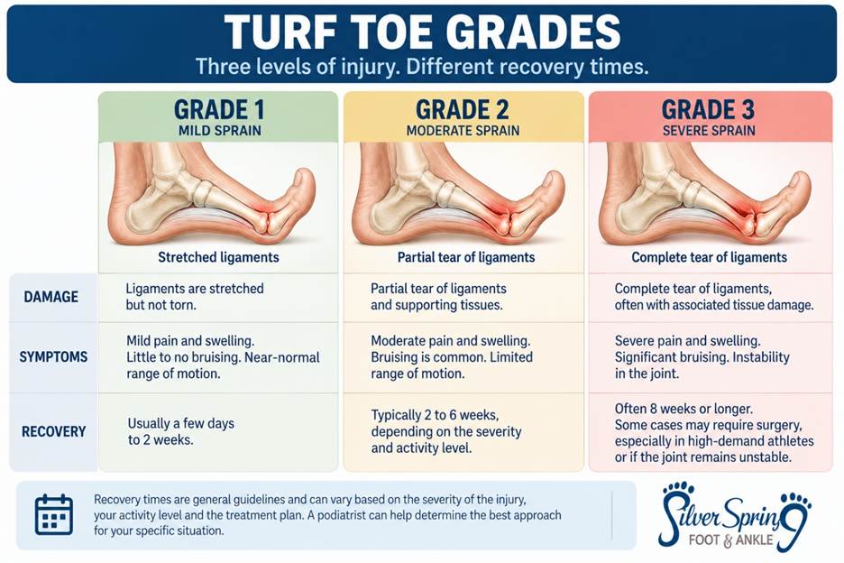 Illustration: Turf Toe Sprain Grades from mild to severe