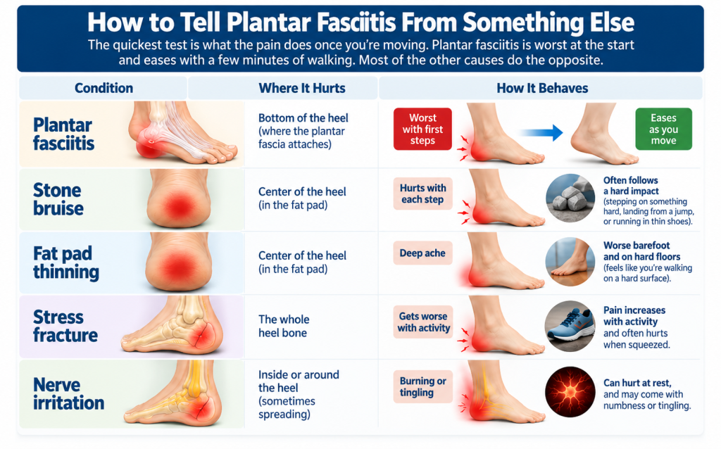 Medical Illustration: How to tell plantar fasciitis from something else