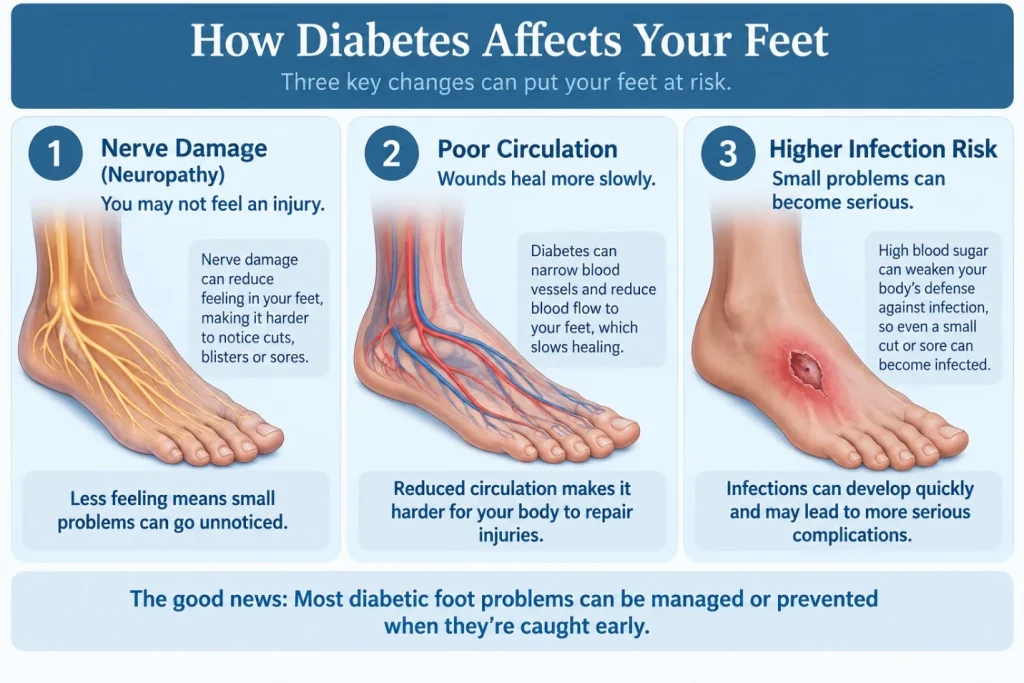 How diabetes affects your feet: nerve damage means an injury may not be felt, poor circulation slows healing, and high blood sugar raises the risk of infection