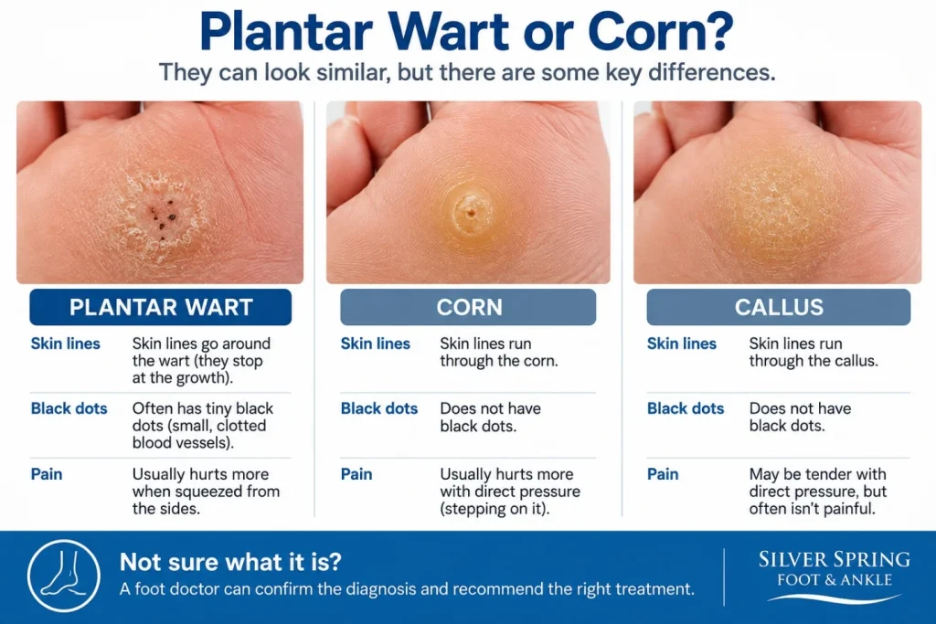 Plantar wart, corn or callus: skin lines go around a wart but run through a corn or callus, warts often have tiny black dots, and a wart usually hurts more when squeezed from the sides