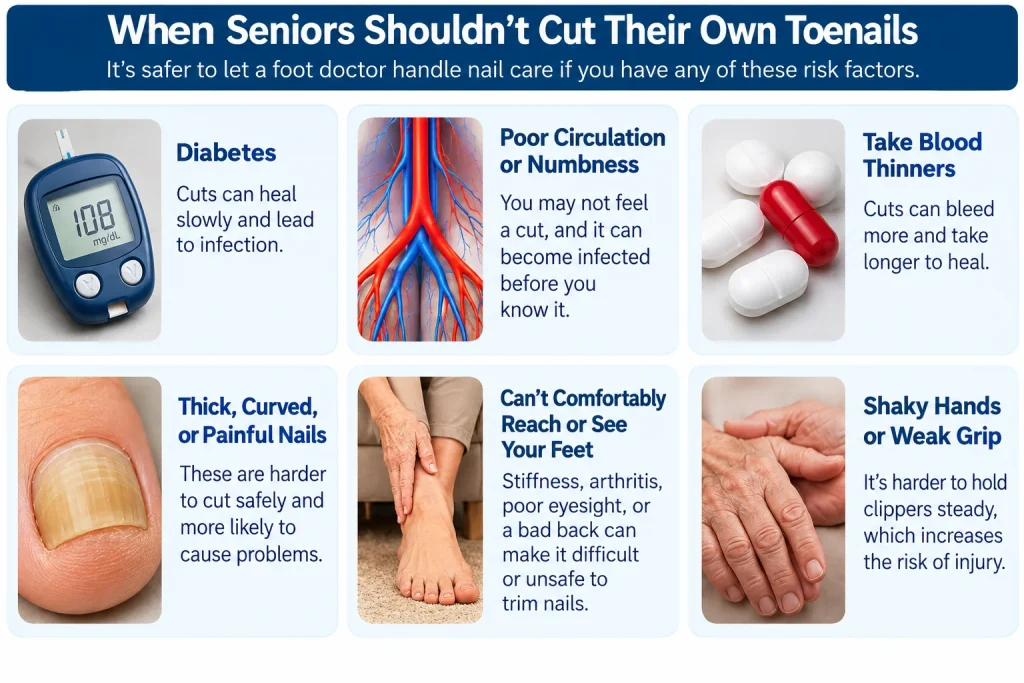Illustration: When seniors shouldn’t cut their own toenails: diabetes, poor circulation or numbness, blood thinners, thick or curved nails, trouble reaching the feet, and shaky hands